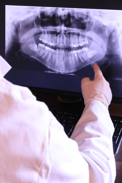 Best Emergency Dentist for Knocked-Out Tooth in Lake Los Angeles, CA